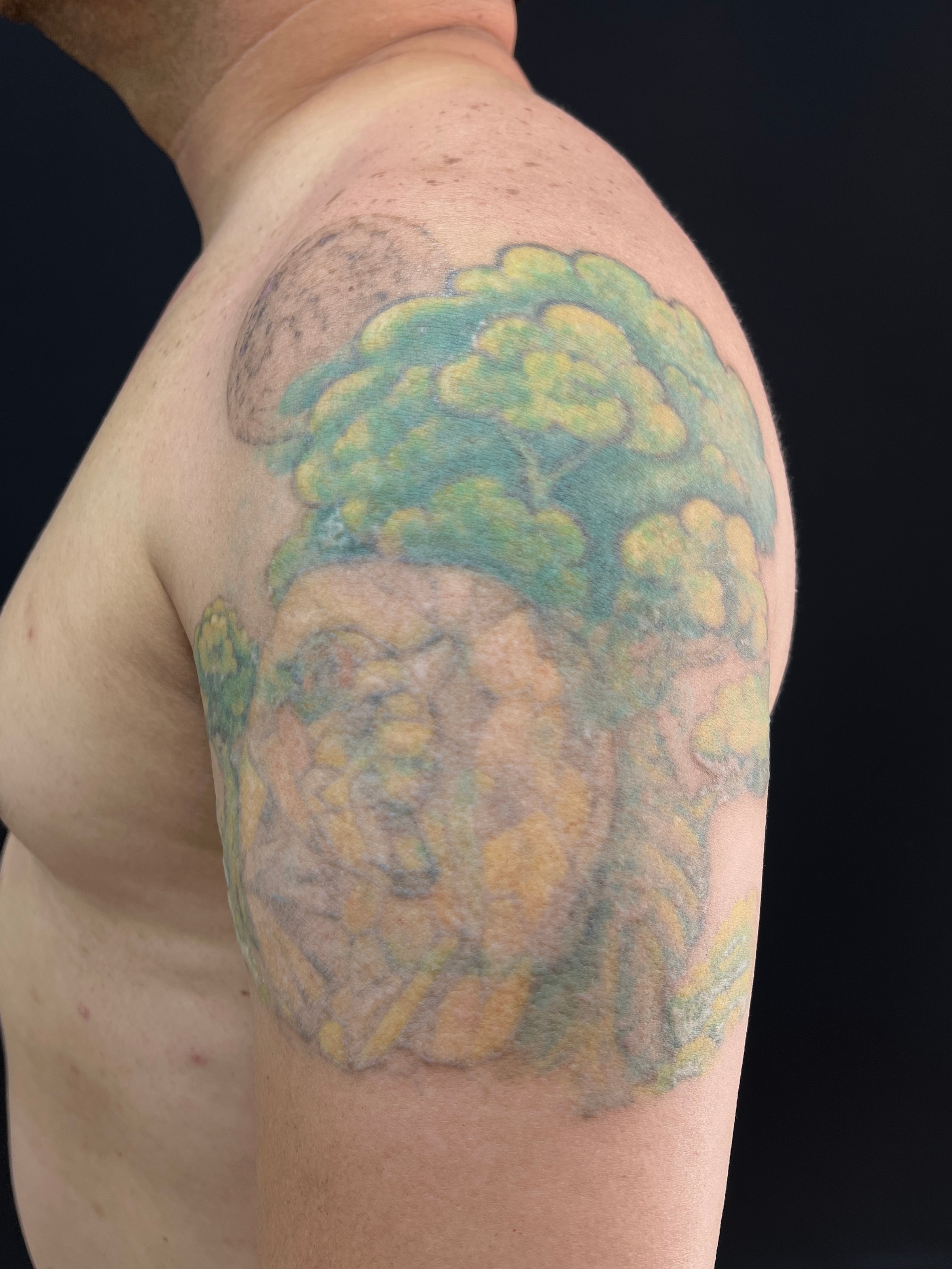 Cover-up antes: tatuaje verde y amarillo desvanecido en el hombro