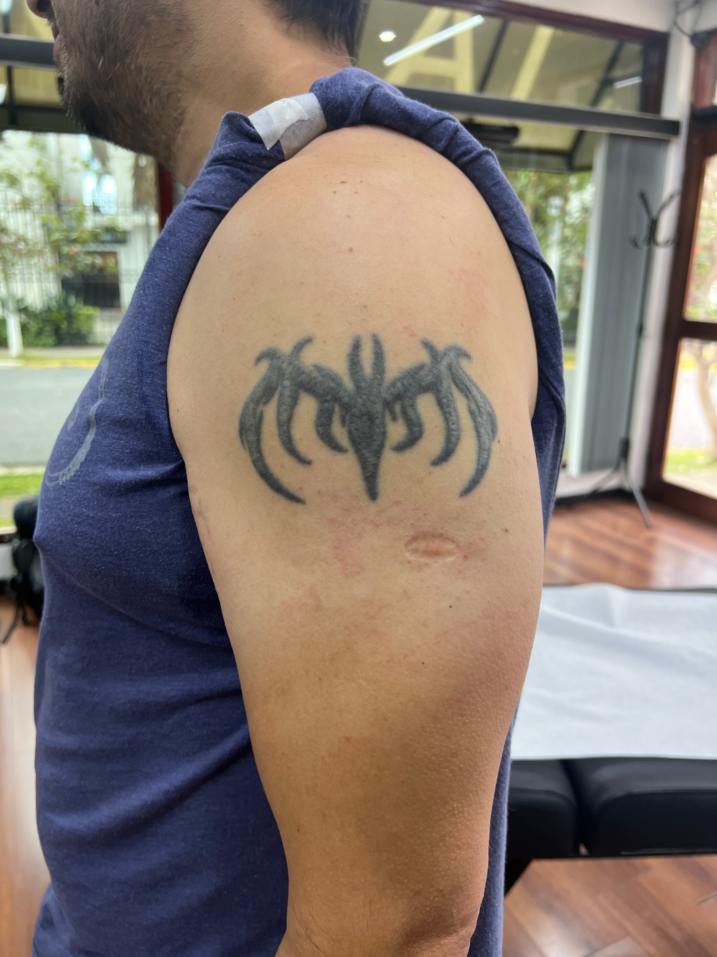 Cover-up antes: blackwork parcial en el hombro